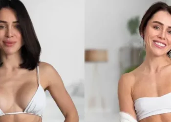 Натуральність як новий тренд. Чому українки почали зменшувати губи і груди