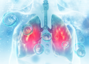 Рак легень серед некурців: у чому головна причина зростання захворюваності