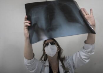 В Україні рентген та КТ пацієнти мають отримувати безоплатно: куди телефонувати, коли вимагають гроші