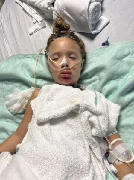 7-річна дівчинка опинилася в комі після вірусного челенджу TikTok: що вона зробила (фото)