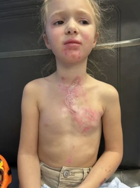 7-річна дівчинка опинилася в комі після вірусного челенджу TikTok: що вона зробила (фото)