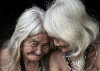 Ці продукти “вбивці краси” — не допоможе навіть догляд за шкірою