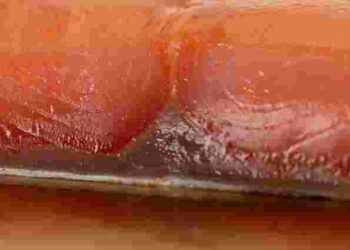 Як зняти шкіру з лосося за 15 секунд: три прості методи від шеф-кухаря