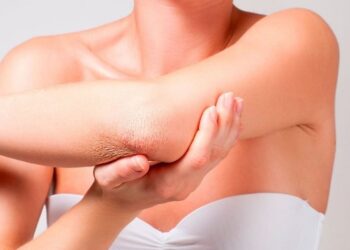 Суха шкіра на ліктях — чому і як це виправити