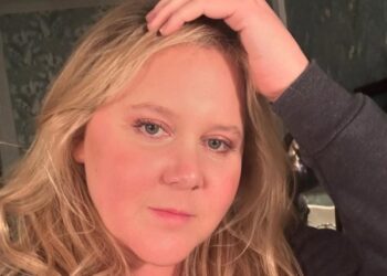 Що таке «кортизолове обличчя» і чи потрібно його прибирати: правда і міфи