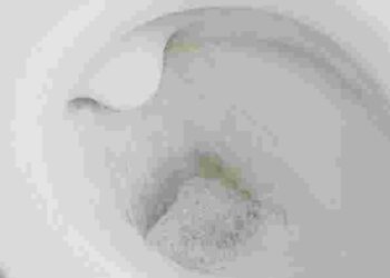 Ризикуєте своїм здоровʼям: чому завжди треба закривати кришку унітаза під час змивання