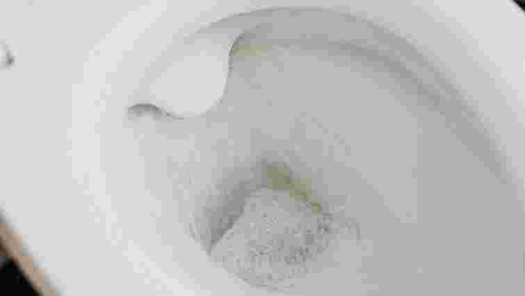 Ризикуєте своїм здоровʼям: чому завжди треба закривати кришку унітаза під час змивання