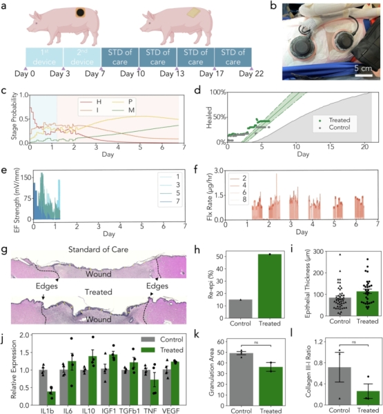 Пристрій з камерою та ШІ загоює рани на 25% швидше
