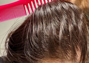 Новий тренд у TikTok може призвести до облисіння: експерти б’ють на сполох