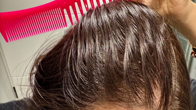 Новий тренд у TikTok може призвести до облисіння: експерти б'ють на сполох