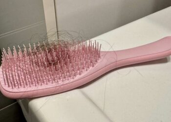 «Сплячі цибулини волосся» — міф чи реальність? Що насправді відбувається під час випадіння