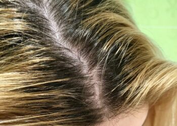 2 погані і 3 корисні поради для тих, чиє волосся швидко жирніє