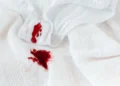 Як відіпрати жовті плями від поту на білому одязі домашніми засобами