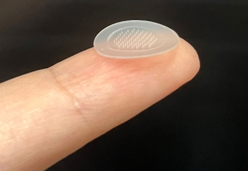 Підлітковий хіт: розумний пластир з чипом лікує акне за тиждень