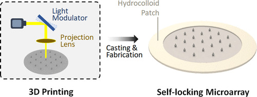 Підлітковий хіт: розумний пластир з чипом лікує акне за тиждень